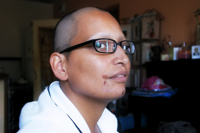 Man in chemotherapy